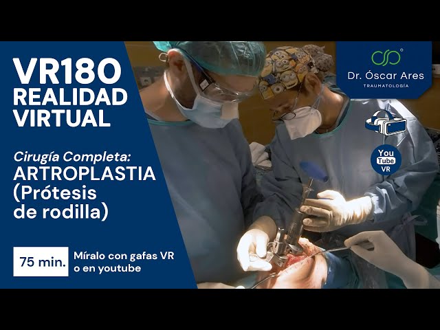 VR180 Cirugía Completa ARTROPLASTIA (Prótesis de rodilla) - Dr. Oscar Ares