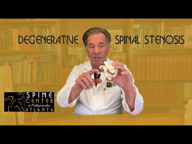 Dr. Chappuis Explains Degenerative Spinal Stenosis