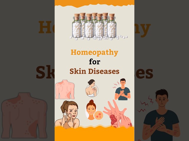 Homeopathy for Skin Diseases | Life Force Homeopathy #homeopathyheals