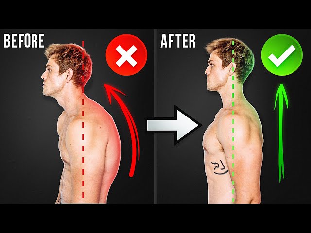 How To Fix Your Sh*tty Posture In 10 Minutes (Daily Routine)