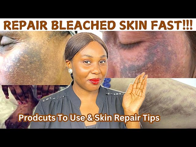 How To Repair Bleached / Damaged Skin For A Healthy Glow