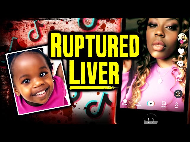 TikToker Mom Crushes Her Childs Ribs & Tears Her Liver