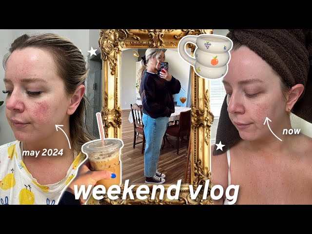 how i'm healing my skin (update), costco haul & going to a target "outlet"!