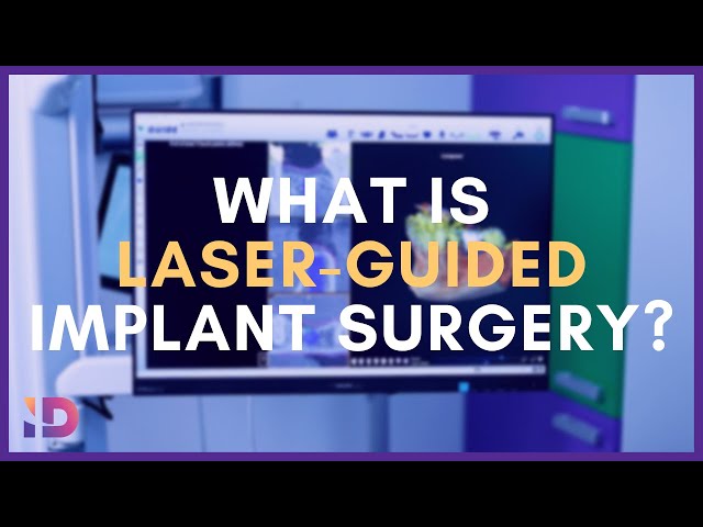 What is Laser-guided Implant Surgery? | Integrated Dentalcare #edinburgh #dentist #technology