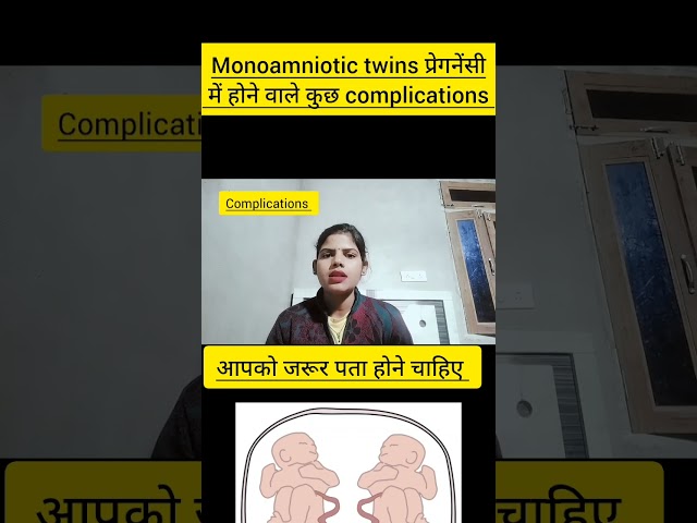 Monochorionic monoamniotic twins pregnancy me kya risk hote hai complications in monoamniotic twins