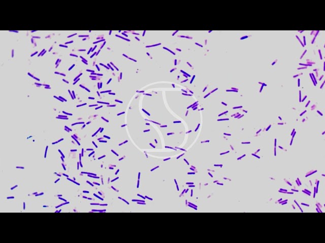 Clostridium difficile under the microscope with Gram stain