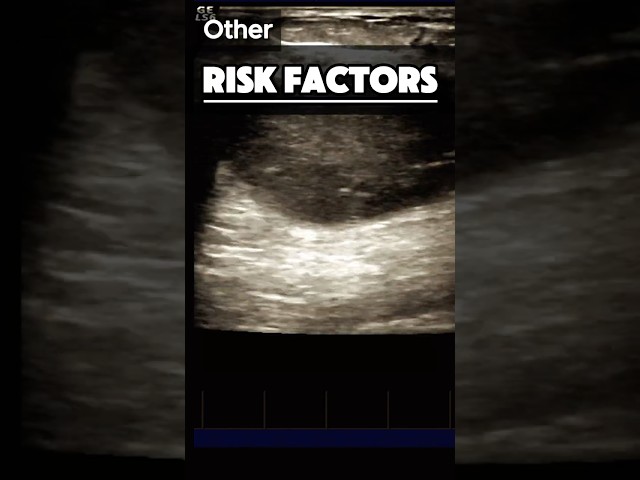 Breast Lump - Cancer | Early Treatment | RISK FACTORS | Ultrasound