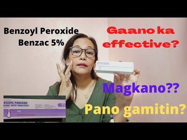 Gamot sa pabalik balik na acne at pimples / Benzoyl Peroxide review / Pimple and Acne Solution