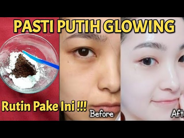 CARA MEMUTIHKAN WAJAH KUSAM JADI PUTIH GLOWING / CARA AGAR WAJAH CEPAT PUTIH GLOWING