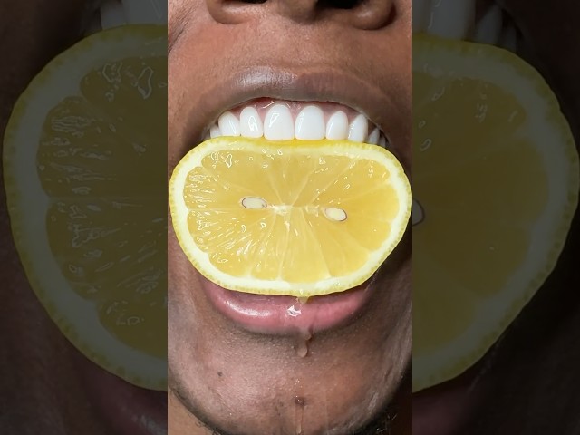 🍋🍋 #teeth