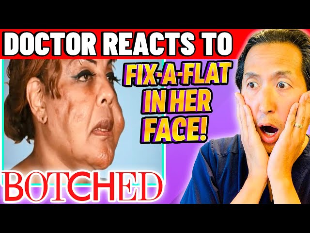 Plastic Surgeon Reacts to BOTCHED: CONCRETE and FIX-A-FLAT In The FACE?!?!