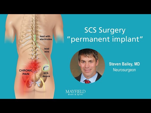 HF10 Spinal Cord Stimulation: Part 2 Surgery