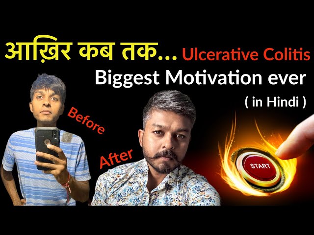 आख़िर कब तक 🔥🔥/ Ulcerative Colitis Biggest Motivational Video in hindi / colitis treatment in hindi