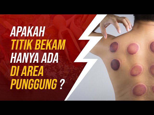 Apakah Titik Bekam Hanya Area Punggung Saja ?