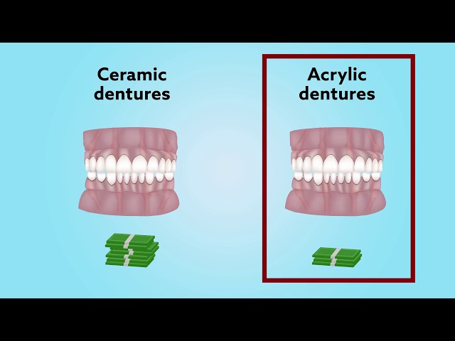 Long-term comparison of acrylic vs. ceramic All-on-4® fixed dentures