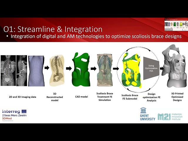 Rational design for 3D printable spinal orthoses