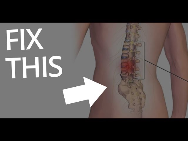 HOW TO FIX LOWER BACK PAIN Simple fixes for sciatica and lower back pain