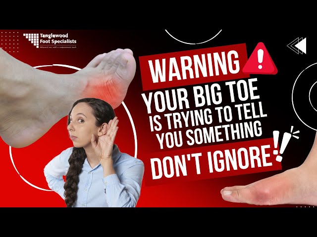 Warning Your Big Toe is Trying to Tell You Something (Don't Ignore)