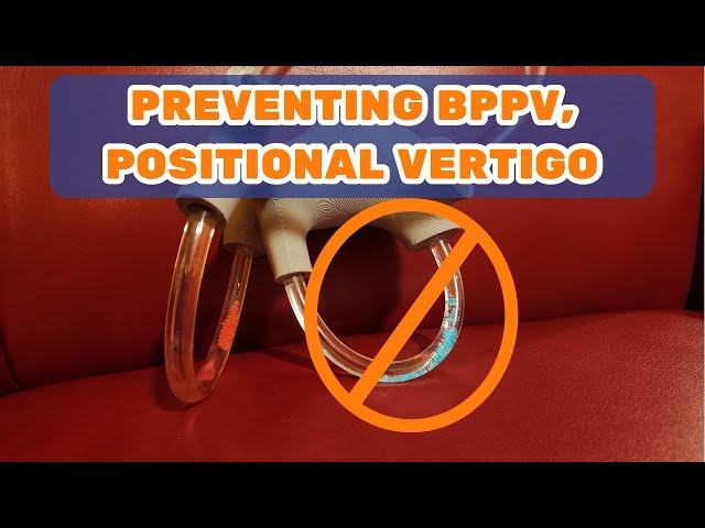 How to PREVENT Positional Vertigo (BPPV) - Dizzy Therapy