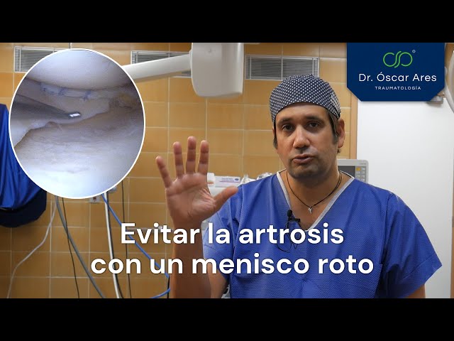 Evitar la artrosis con un menisco roto - Dr. Oscar Ares