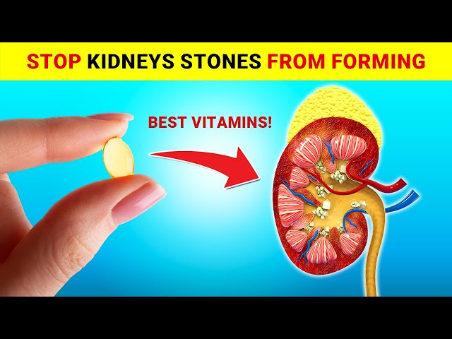 5 Best Vitamins to Prevent Stones and Heal Your Kidneys