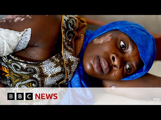 DR Congo war: Rape survivors recall horror of Goma jailbreak | BBC News