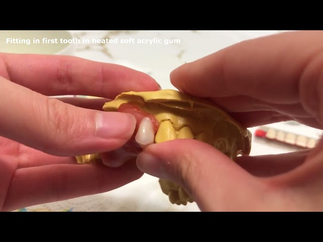 Make the PERFECT Denture Do-It-Yourself Dentist Quality DIY Best Dentures