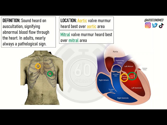 72 SECONDS on AORTIC and MITRAL MURMURS (Important clinical skills!)