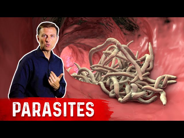 The Best Herbs for Parasites