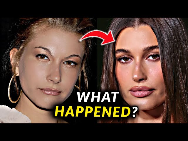 Hailey Bieber's Face - Before and After