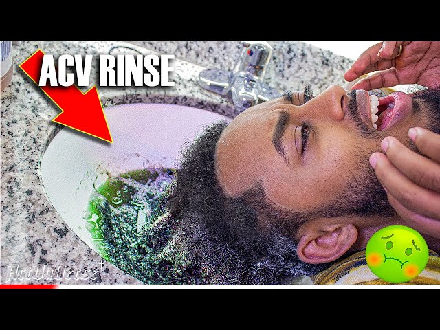 NASTY ACV Rinse On 2 Years Dreadlocks 🤢 | BUILD UPS