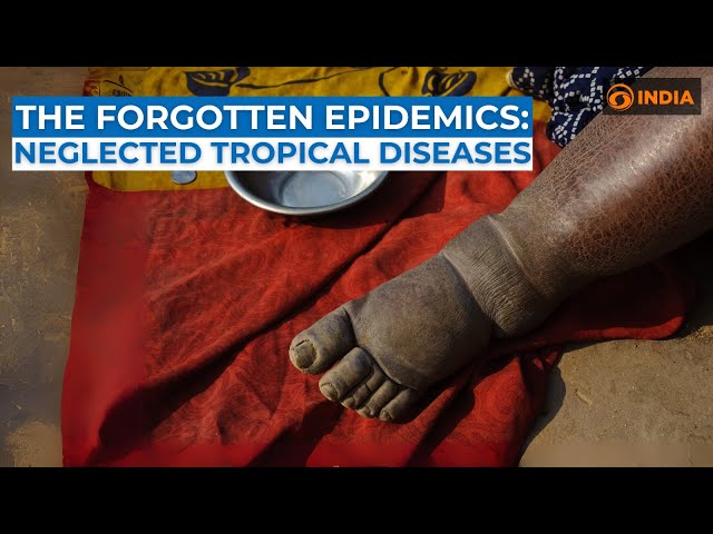 The Forgotten Epidemics: Neglected Tropical Diseases | Wellness Watch