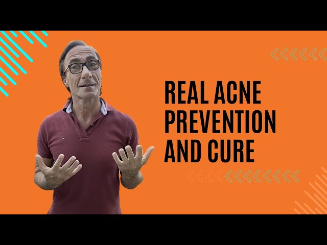 Real Acne Prevention and Cure