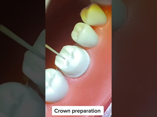 Crown Preparation #dentalstudents