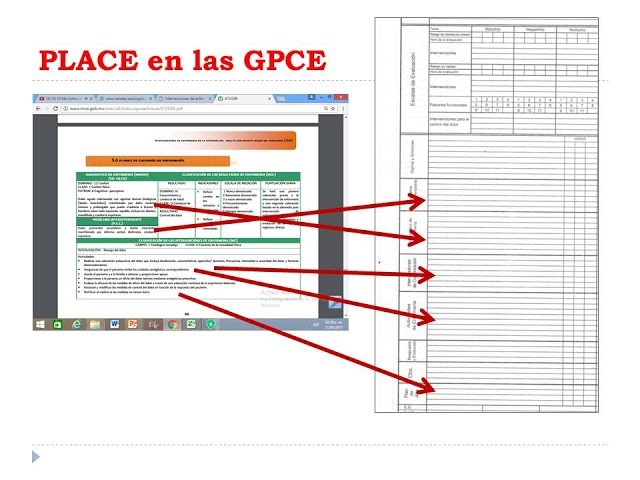 Guías de Práctica Clínica y PLACE en los Registros Clínicos de Enfermería: Videoconferencia