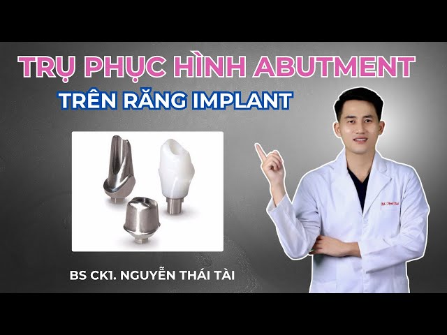 Trụ Phục Hình Trên Implant Là Gì ? Có Bao Nhiêu Loại ? | Bác Sĩ Tài Tử Tế