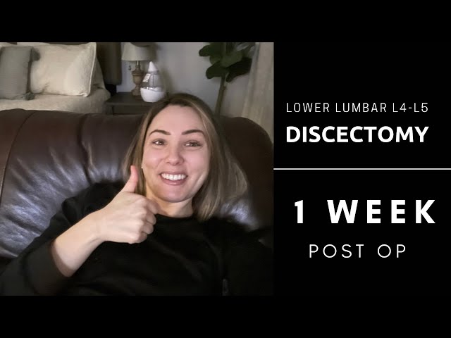 Lower Lumbar Discectomy L4-L5 | 1 Week Post Op