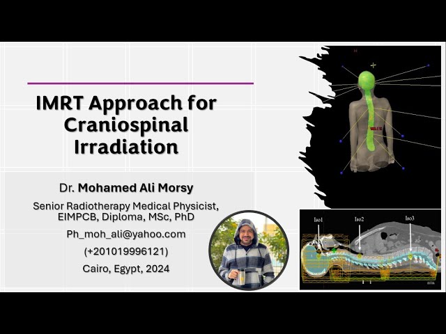 IMRT Technique for Craniospinal Irradiation Radiotherapy Treatment