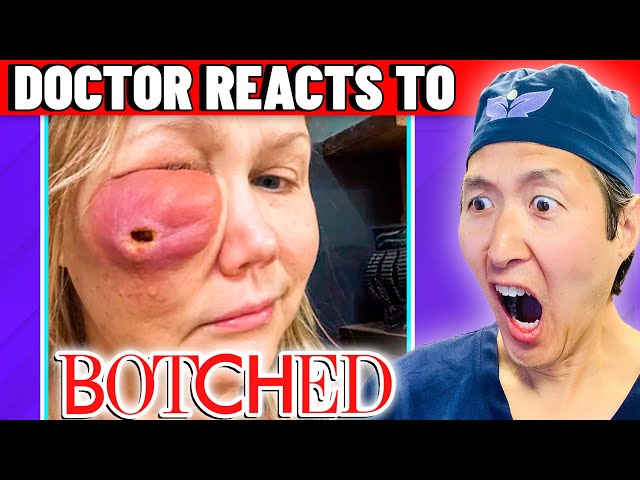 Plastic Surgeon Reacts to BOTCHED: Facial Fillers Did THIS?!?