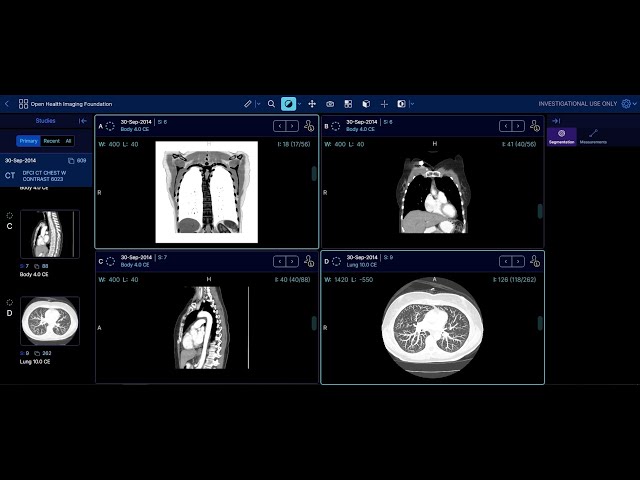 OHIF Viewer:  A React Case Study