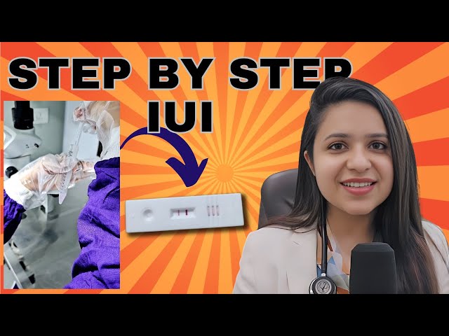 IUI process step by step | IUI treatment for pregnancy