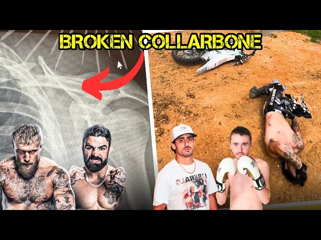 BROKEN COLLARBONE & BEEF WITH BETR DEREK - VLOG #6