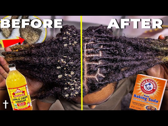 HOW TO ACV RINSE YOUR DREADLOCKS | Step By Step Tutorial