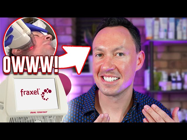 Best laser for anti aging? (Before and after Fraxel Dual) | SwoleMD Skincare