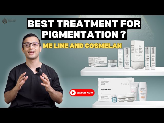 ME Line and Cosmelan Skin Treatments | Best Pigmentation Treatment | Effects and Side Effects