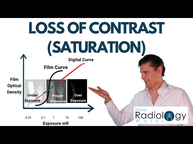 X-ray Saturation (Loss of Contrast)