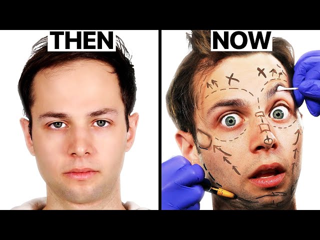 Should The Try Guys Do Plastic Surgery? | Surgeon Reacts