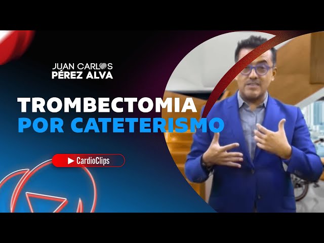 TROMBECTOMIA POR CATETERISMO (Serie CARDIONUCLEOS)