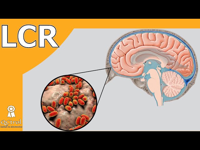 Cerebrospinal fluid (CSF): Chemical, cytological and culture analysis