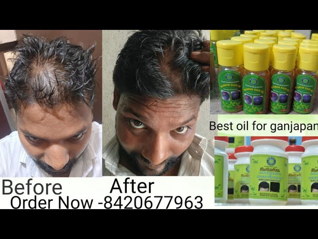 New Regrow Hair oil & Best oil For Ganjapan and Stopped Hair Fall